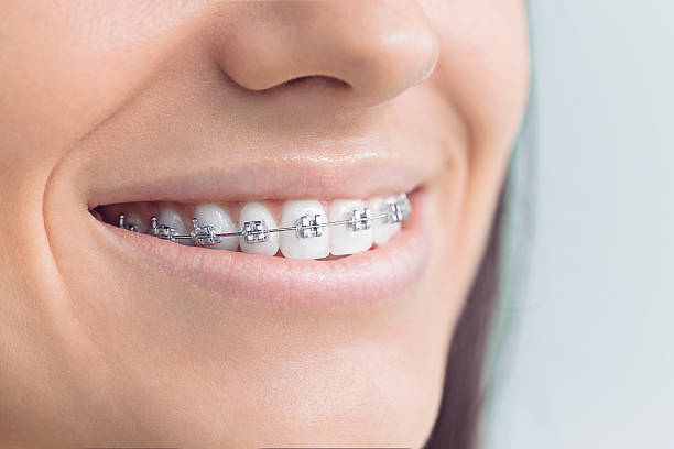 Best Dental X-Rays and Imaging  in Al Creek, CO